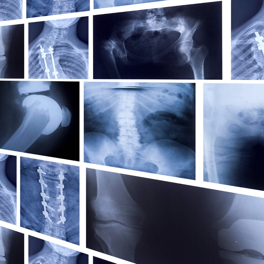 Diagnostic imagery representing pipeline diagnosis